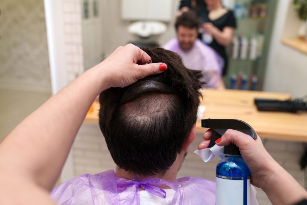 haar system gegen haarausfall